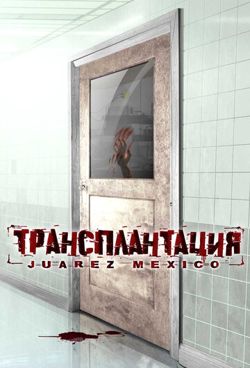 Трансплантация (2005)